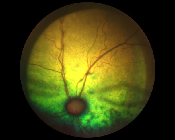 Таурин-дефицитная ретинопатия кошек