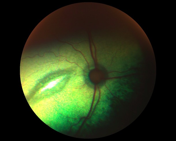 Таурин-дефицитная ретинопатия кошек